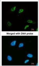 SMC3 Antibody in Immunocytochemistry (ICC/IF)