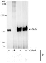 SMC3 Antibody in Immunoprecipitation (IP)