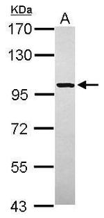 PYGM Antibody in Western Blot (WB)