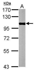 PYGM Antibody in Western Blot (WB)