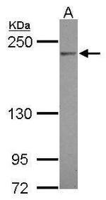 Complement C4 Antibody in Western Blot (WB)