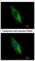 Cytokeratin 6 Polyclonal Antibody