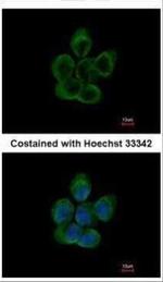 TUBA8 Antibody in Immunocytochemistry (ICC/IF)