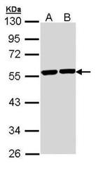 TUBA8 Antibody in Western Blot (WB)