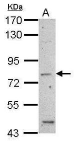 alpha-ENaC Antibody in Western Blot (WB)