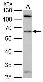 YY1 Polyclonal Antibody