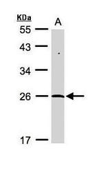 SENP8 Antibody in Western Blot (WB)