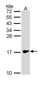 gamma Synuclein Antibody in Western Blot (WB)