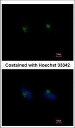 RGS11 Polyclonal Antibody