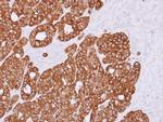 RGS11 Antibody in Immunohistochemistry (Paraffin) (IHC (P))