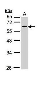 RGS11 Antibody in Western Blot (WB)