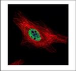 PIASy Polyclonal Antibody