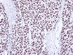 PIASy Antibody in Immunohistochemistry (Paraffin) (IHC (P))