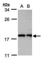 APC11 Polyclonal Antibody