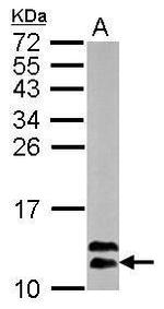 ROC1 Polyclonal Antibody