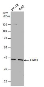 LIMS1 Antibody in Western Blot (WB)