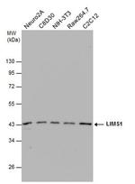 LIMS1 Antibody in Western Blot (WB)
