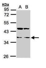 LIMS1 Antibody in Western Blot (WB)