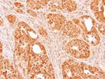 SMYD5 Antibody in Immunohistochemistry (Paraffin) (IHC (P))