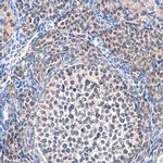SMYD5 Antibody in Immunohistochemistry (Paraffin) (IHC (P))
