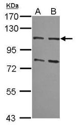 MSH2 Polyclonal Antibody
