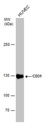 CD31 Antibody in Western Blot (WB)