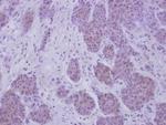 Cdc6 Antibody in Immunohistochemistry (Paraffin) (IHC (P))