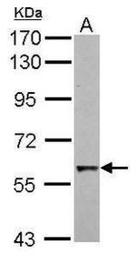 Cdc6 Antibody in Western Blot (WB)