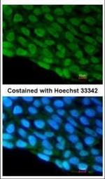 DDX3 Antibody in Immunocytochemistry (ICC/IF)