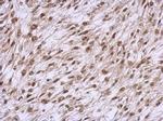 YY1 Antibody in Immunohistochemistry (Paraffin) (IHC (P))