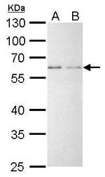YY1 Antibody in Western Blot (WB)