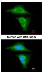 RBP4 Polyclonal Antibody