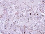 PPT1 Antibody in Immunohistochemistry (Paraffin) (IHC (P))