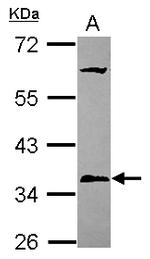 PPT1 Antibody in Western Blot (WB)