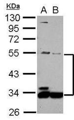 MAPKAP1 Antibody in Western Blot (WB)
