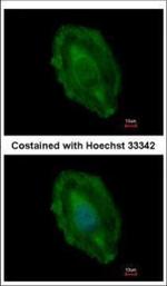 Aspartoacylase Polyclonal Antibody