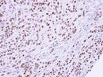 SUMO1 Antibody in Immunohistochemistry (Paraffin) (IHC (P))