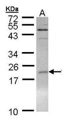 SUMO1 Antibody in Western Blot (WB)