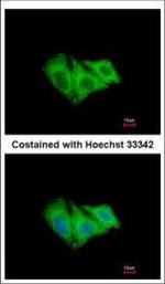 CK2 alpha-1 Antibody in Immunocytochemistry (ICC/IF)