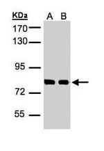HEC1 Polyclonal Antibody