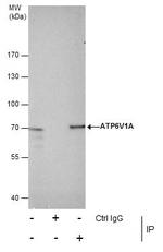 ATP6V1A Antibody in Immunoprecipitation (IP)