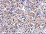 FASTKD5 Polyclonal Antibody