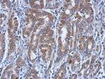 UBE4A Polyclonal Antibody
