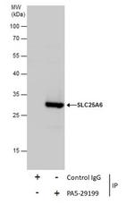 SLC25A6 Antibody in Immunoprecipitation (IP)