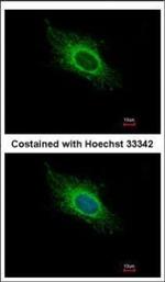 ATP5J Antibody in Immunocytochemistry (ICC/IF)