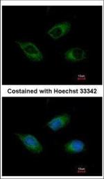 CIDEC Polyclonal Antibody