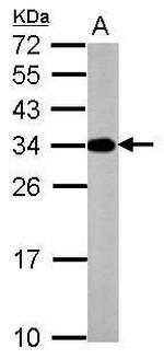 V-ATPase E2 Polyclonal Antibody