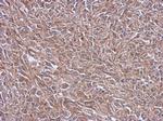 NDUFB4 Antibody in Immunohistochemistry (Paraffin) (IHC (P))