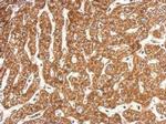 NDUFB4 Antibody in Immunohistochemistry (Paraffin) (IHC (P))
