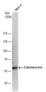 Calcineurin A Antibody in Western Blot (WB)